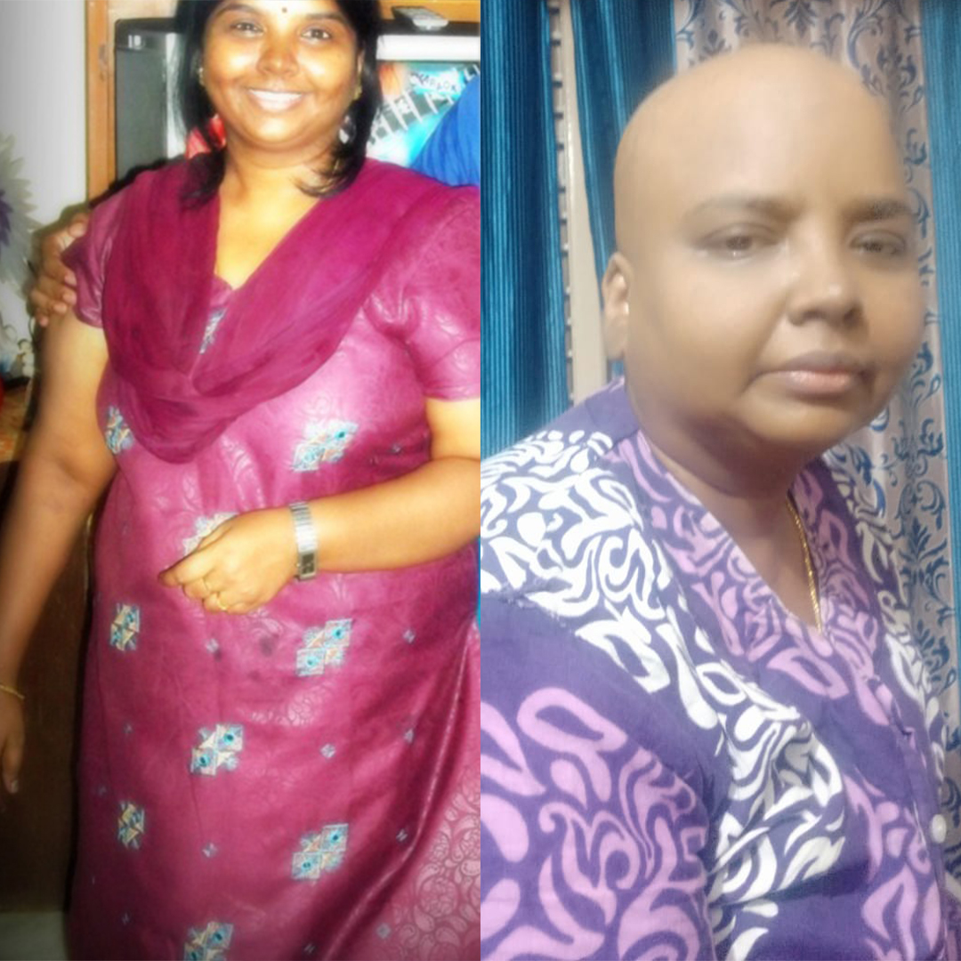 ImpactGuru Handholds Uma in her Fight Against Blood Cancer