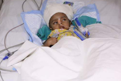 You helped 1-year-old Anas fight fatal brain damage