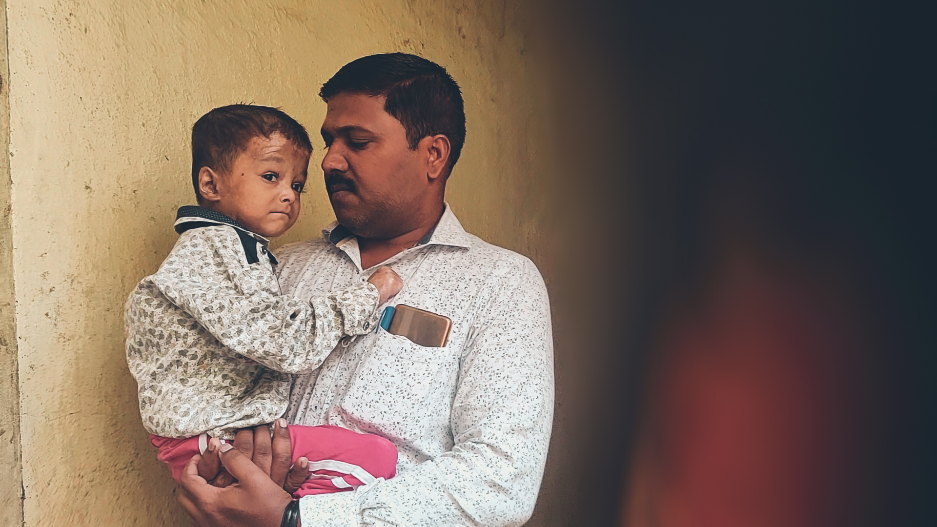 Butterfly boy Harshal can now have reconstructive surgery, thanks to Crowdfunding!