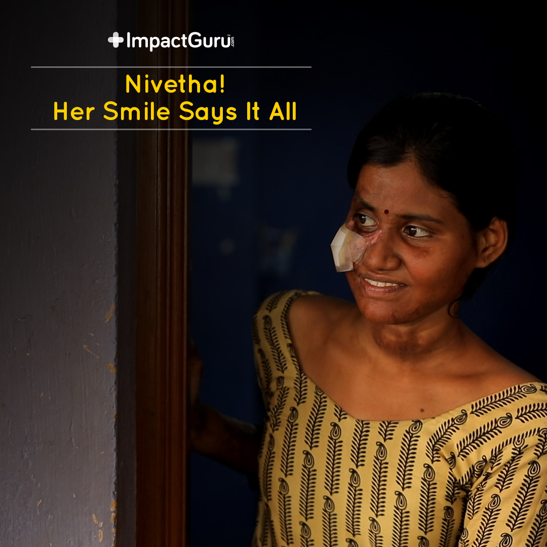 Nivethaâ€™s journey of surviving cylinder blast and getting her surgery.